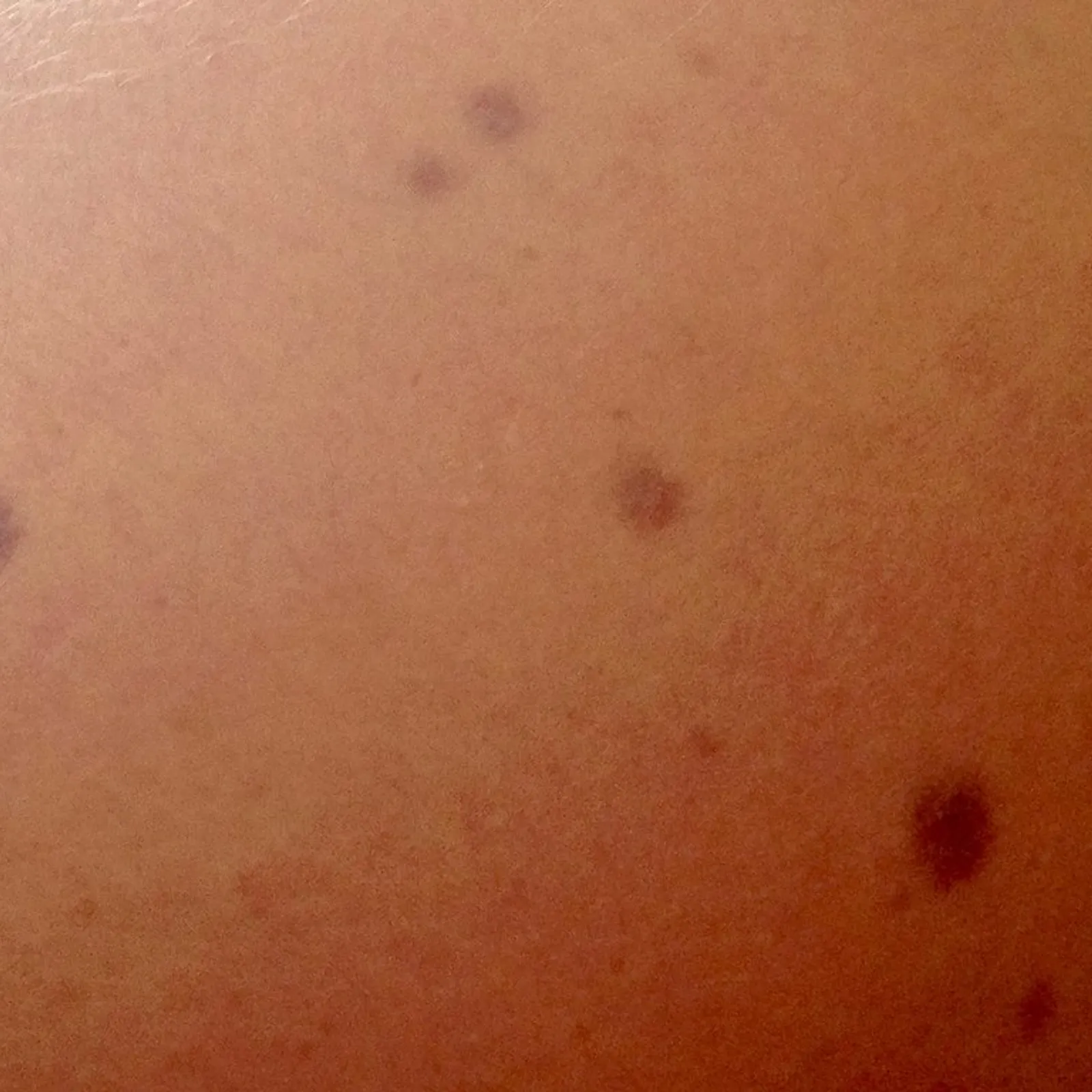 2vn evit kompren ar pikoù du