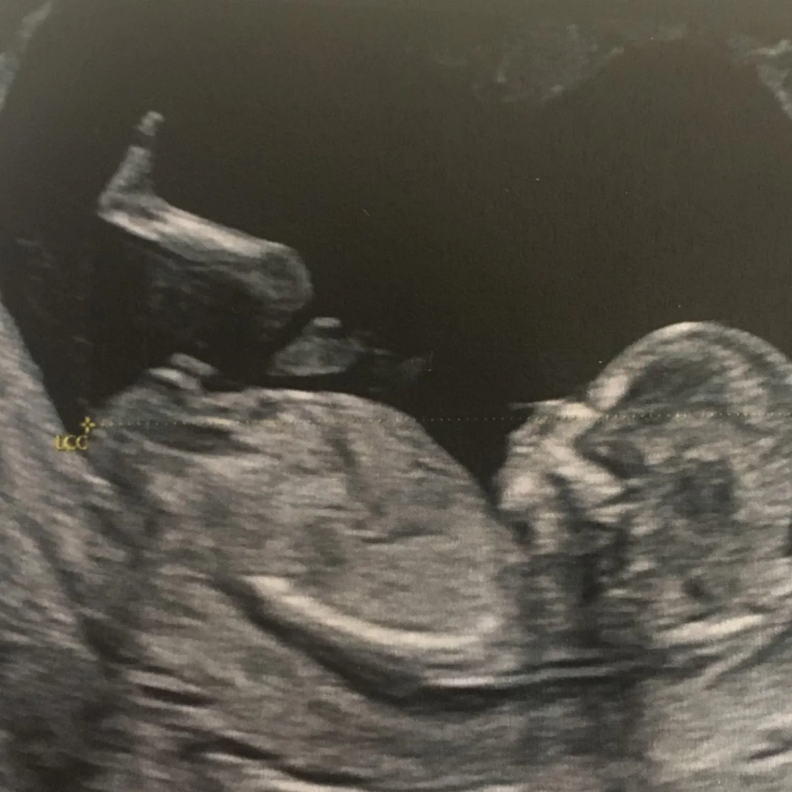 Amélie, échographiste, les yeux rivés in utero.