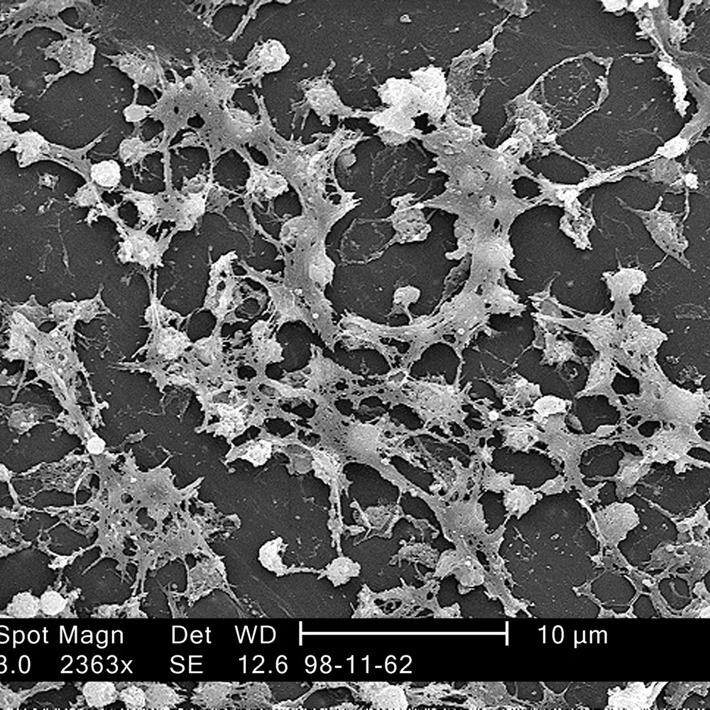 L'antibiorésistance (2/2)