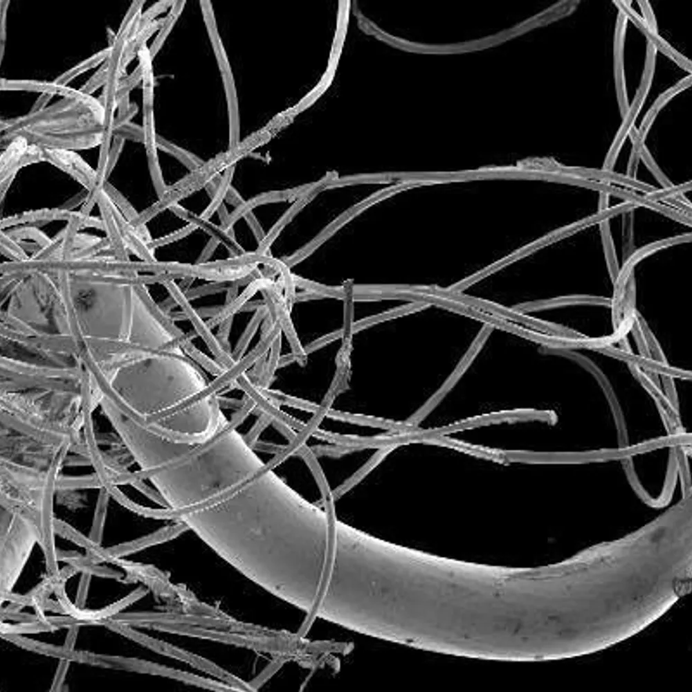 Implants Essure, interview des deux journalistes qui ont enquêté par le média breton Splann!