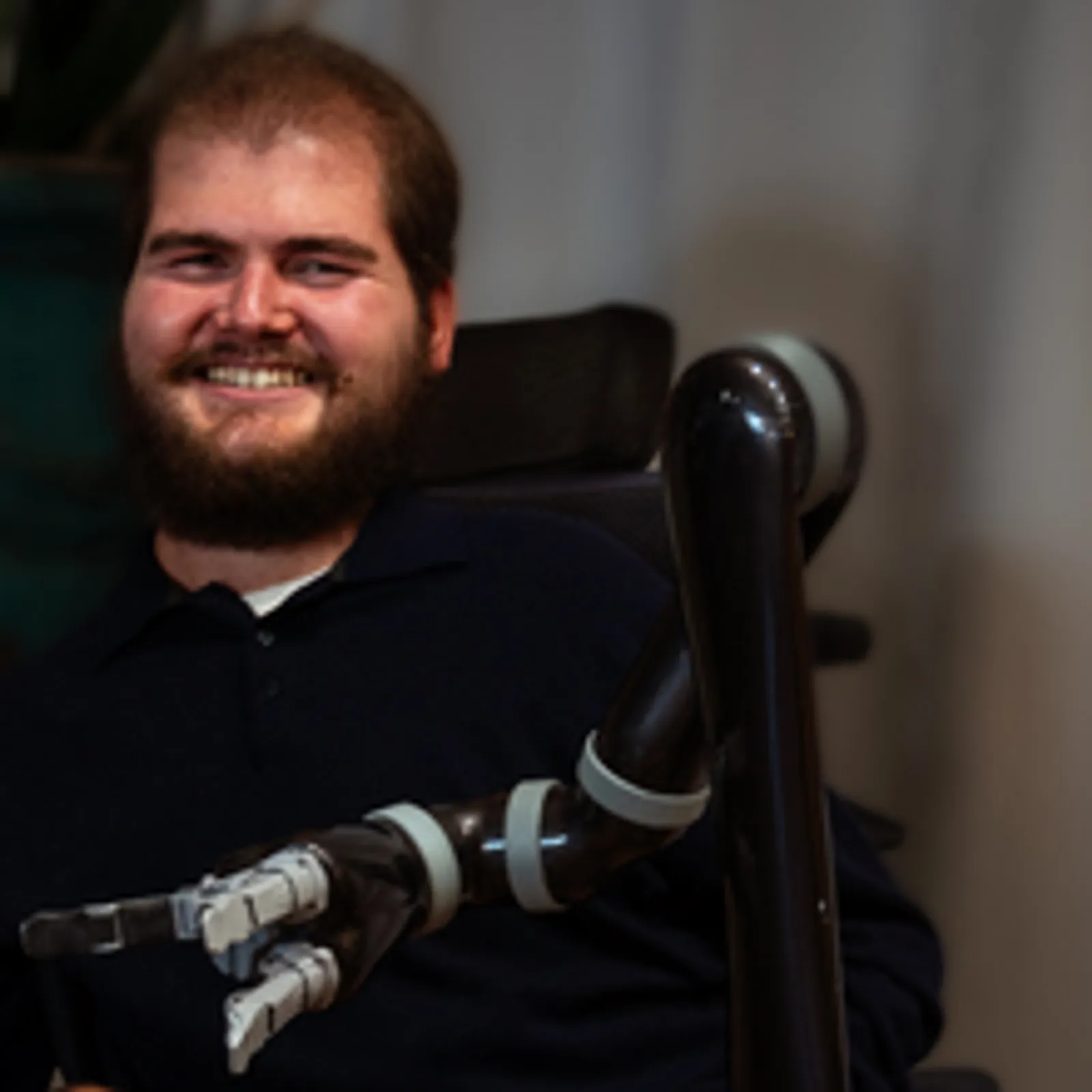 L'ultime cagnotte pour le 3ème bras d'Antoine ?