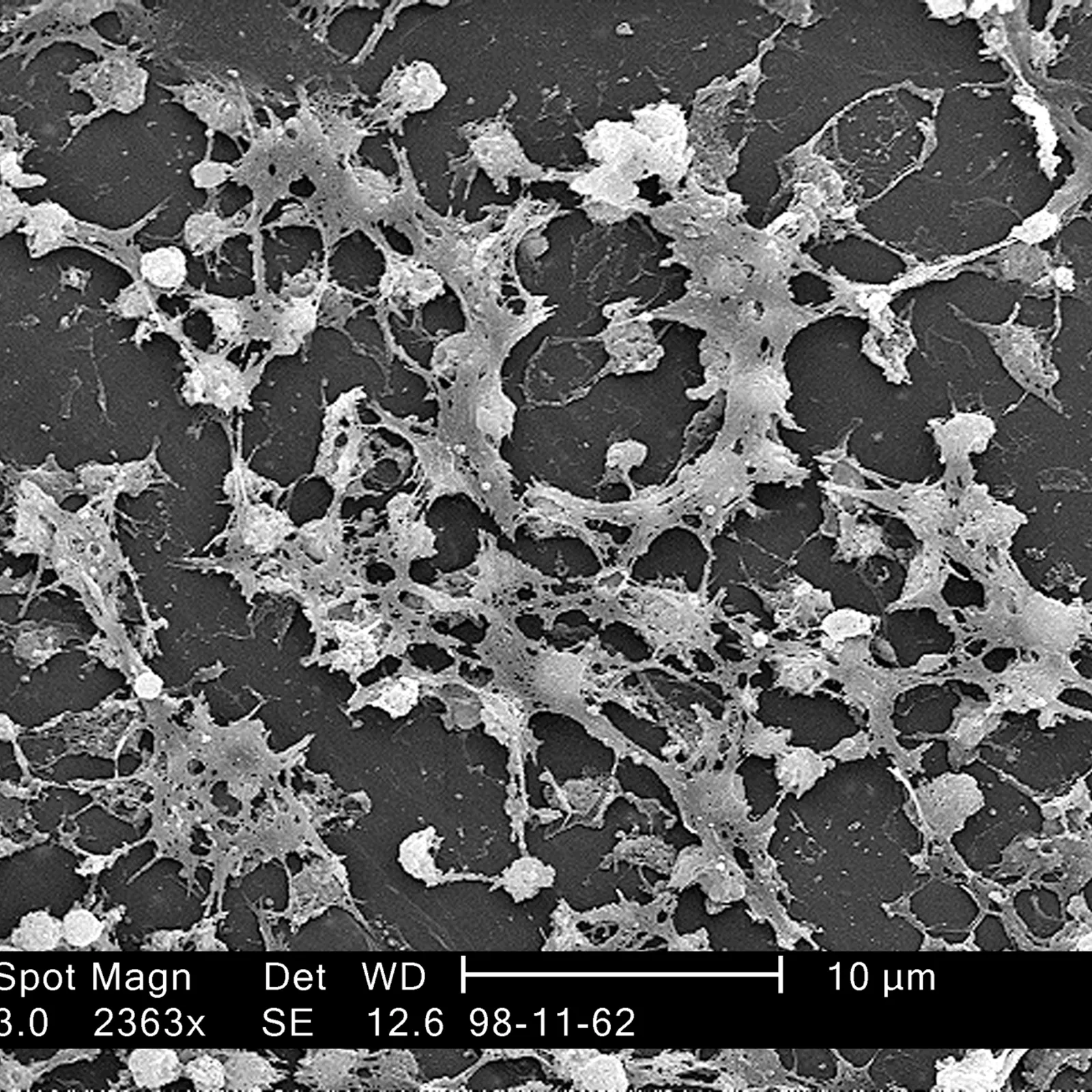 L'antibiorésistance (1/2)