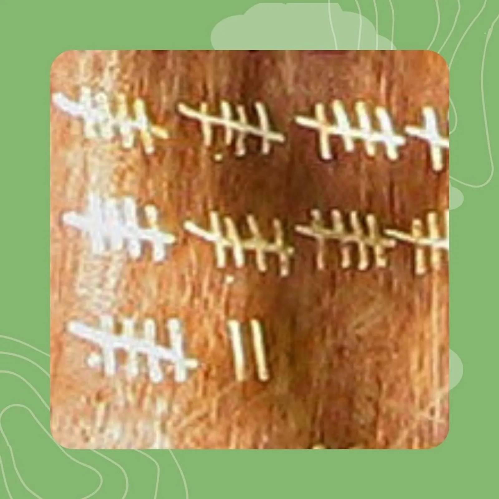 22- Kontañ ha stummañ