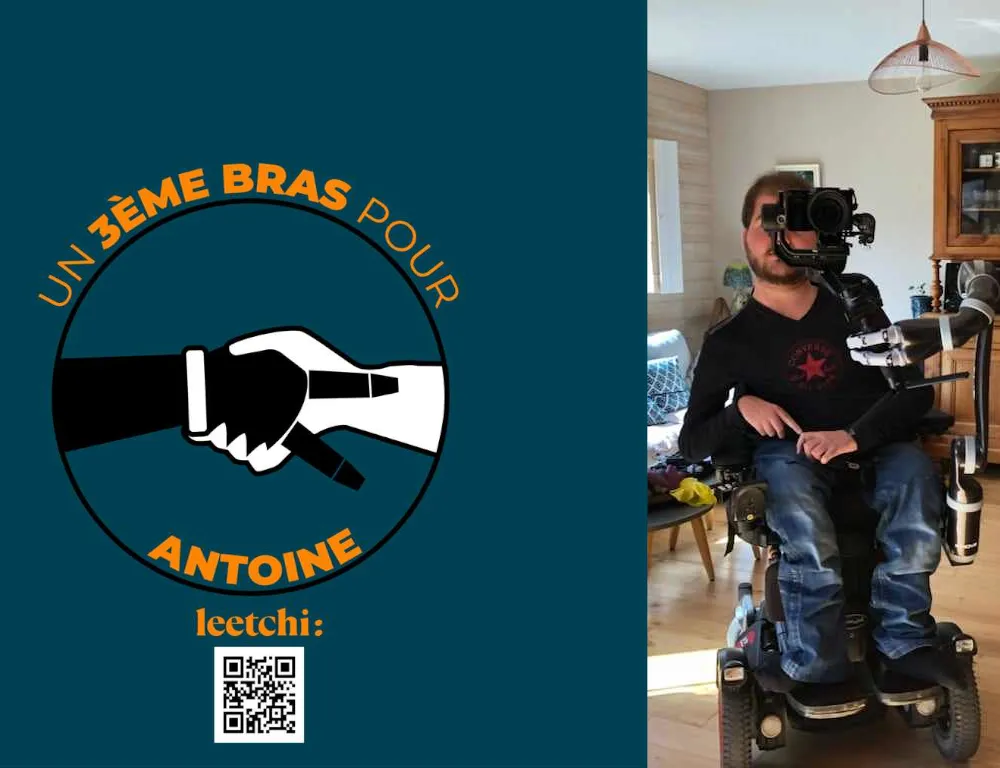 Un 3ème bras pour Antoine