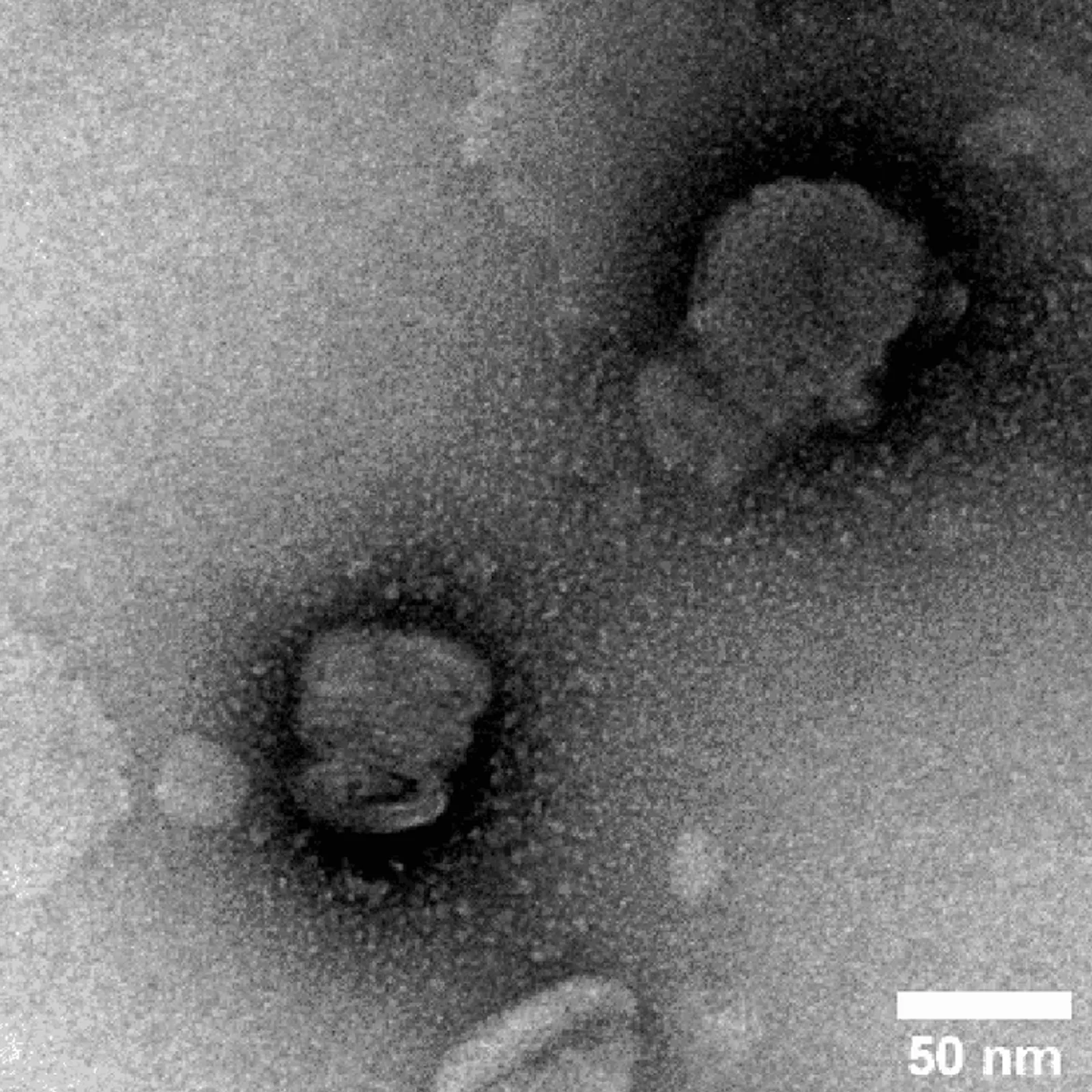 La mucoviscidose, sujet phare du laboratoire de génétique de Brest