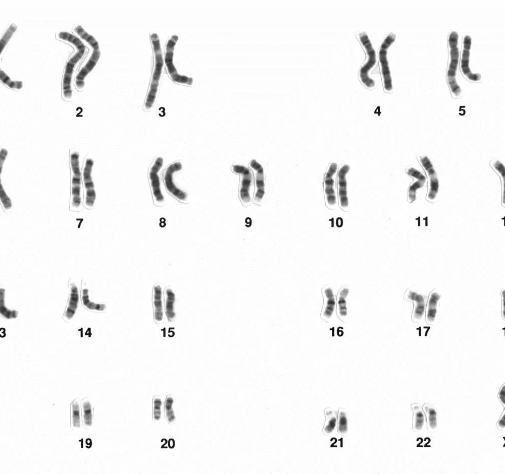 Le chromosome Y